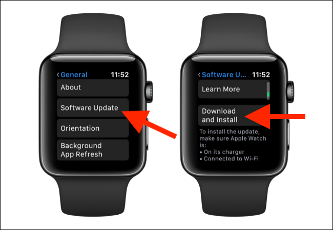 Appuyez sur Mise à jour du logiciel, puis téléchargez la mise à jour