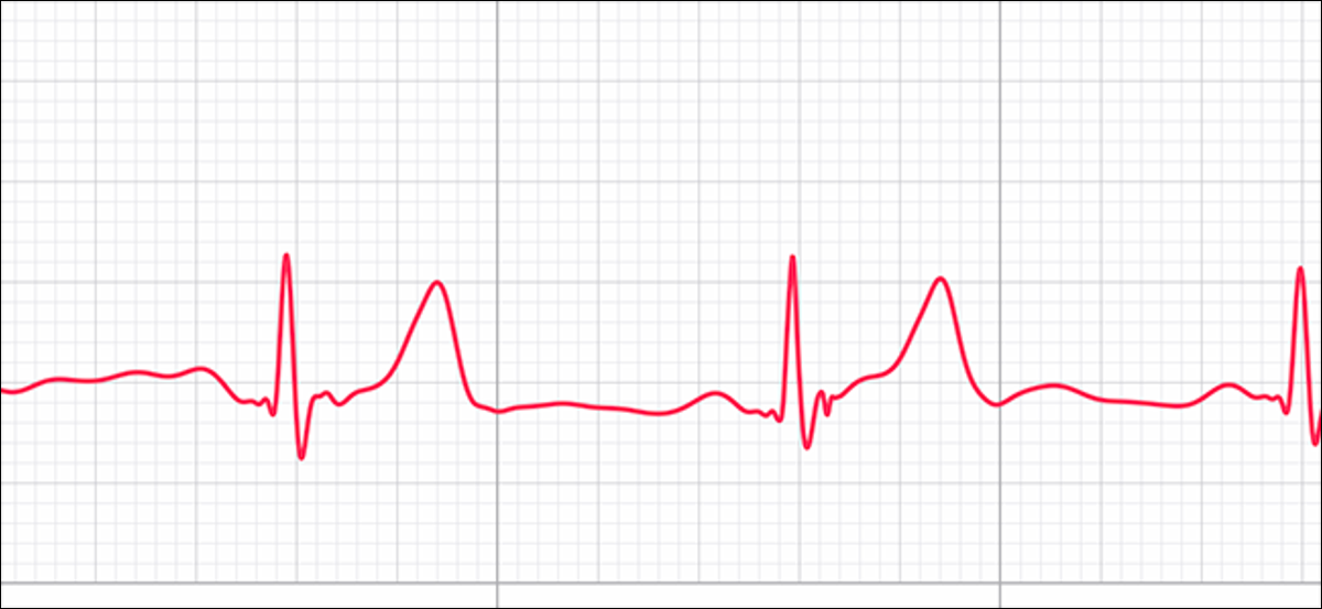 Visualização de ECG mostrando ritmo sinusal