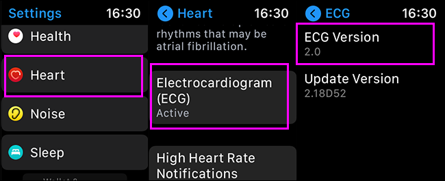 Überprüfen der EKG-Version auf der Apple Watch