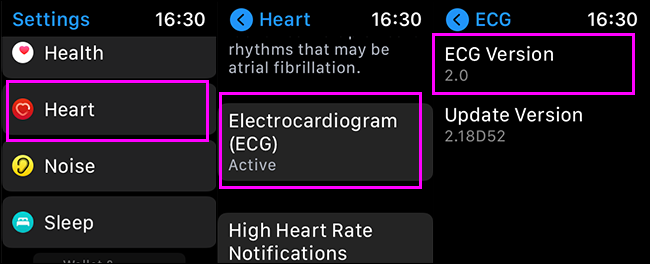 Verificando a versão ecg no Apple Watch